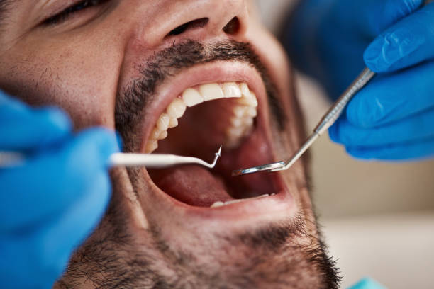 Best Urgent Dental Care for Toothache in Weidman, MI