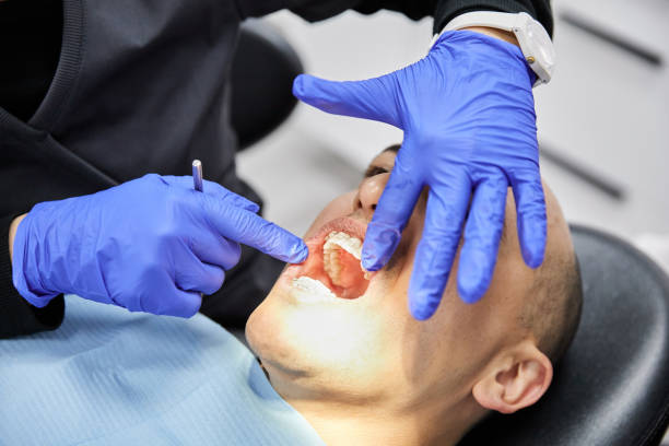 Best Emergency Root Canal Treatment in Weidman, MI