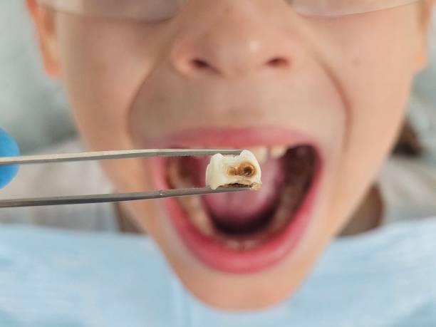 Best Emergency Dentist for Knocked-Out Tooth in Weidman, MI