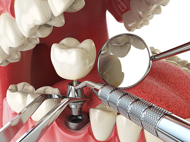 Best Emergency Dentist for Knocked-Out Tooth in Weidman, MI